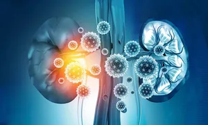 Thận 'kêu cứu' theo 5 giai đoạn